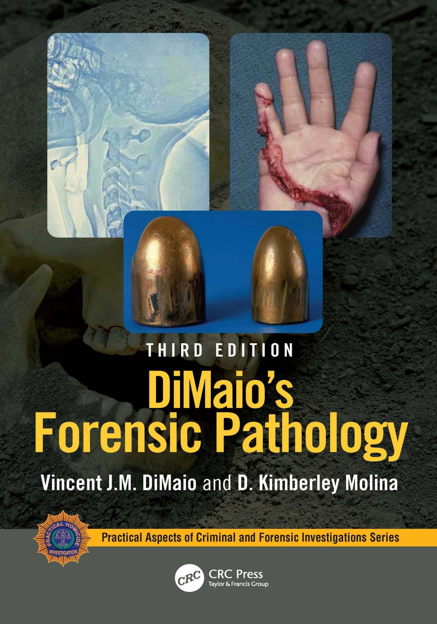 DiMaios-Forensic-Pathology-Practical-Aspects-of-Criminal-and-Forensic-Investigations-by-Vincent-J_M_-DiMaio-D_-Kimberley-Molina.jpg - Magictransferidea