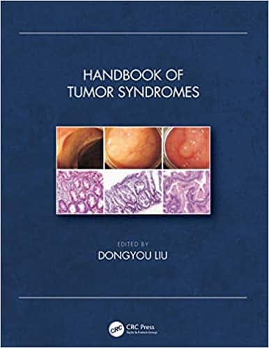 Handbook-of-Tumor-Syndromes-1.jpg - Magictransferidea